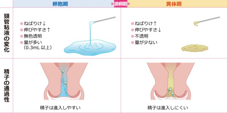 頸管粘膜検査