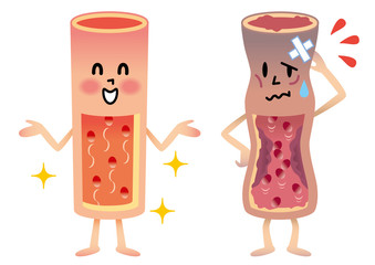 動脈硬化発症の原因に