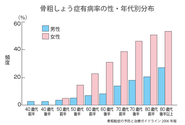 骨粗しょう症｜盛岡市の今井産婦人科内科クリニック