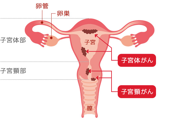 宮頸 癌 検診 子 子宮頸がん